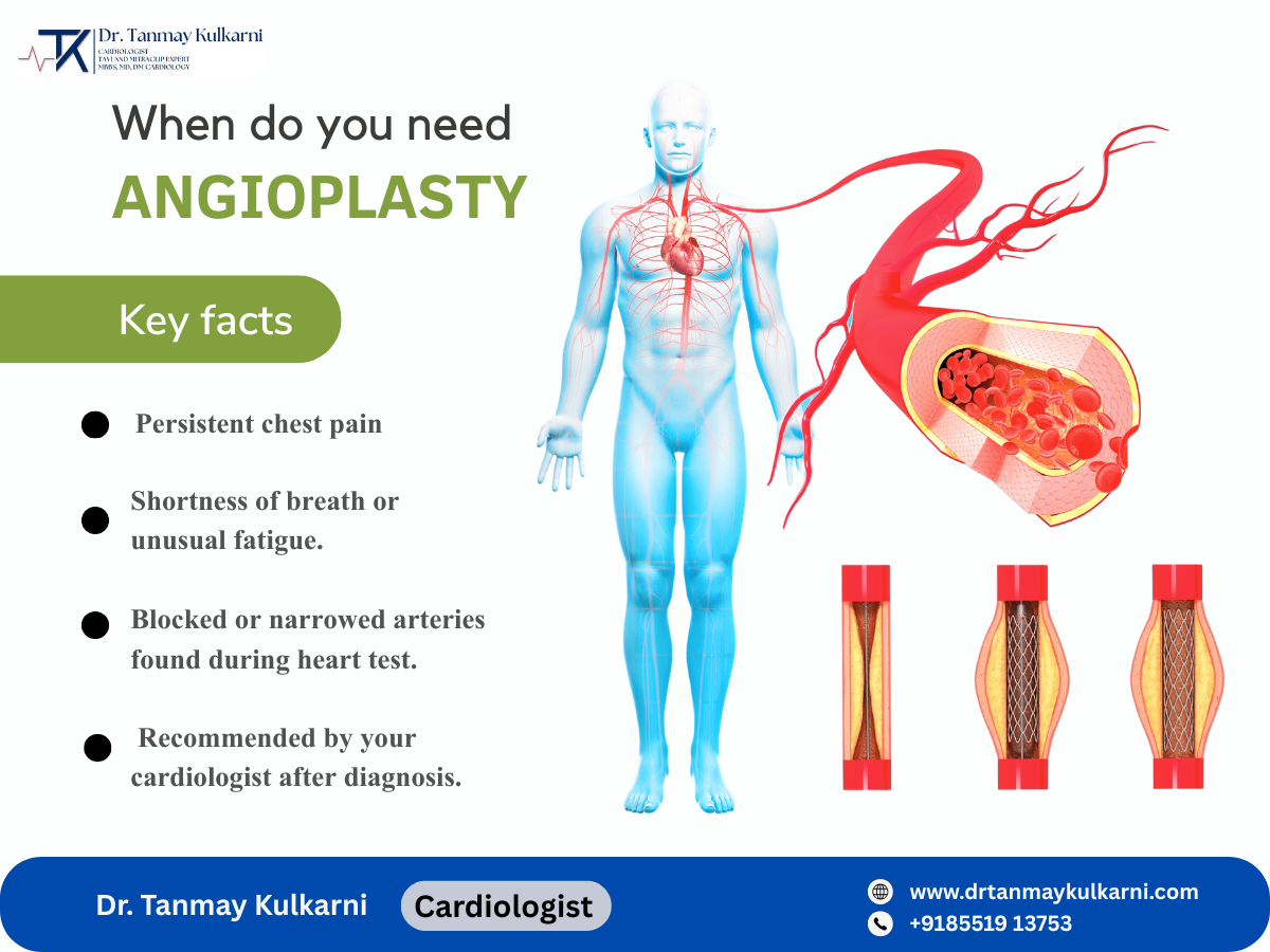 When Do You Need Angioplasty? Understanding the Signs and Treatment Options