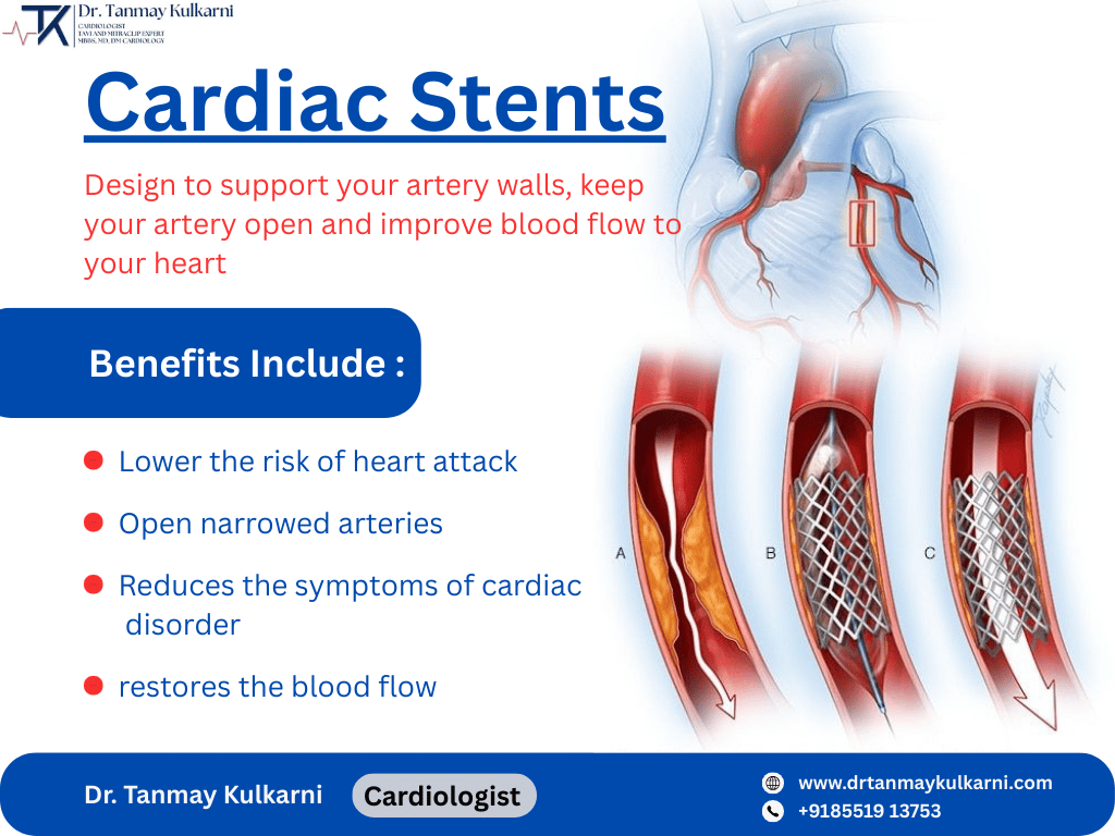 How Cardiac Stents Save Lives: Expert Cardiologist in Pune Explains