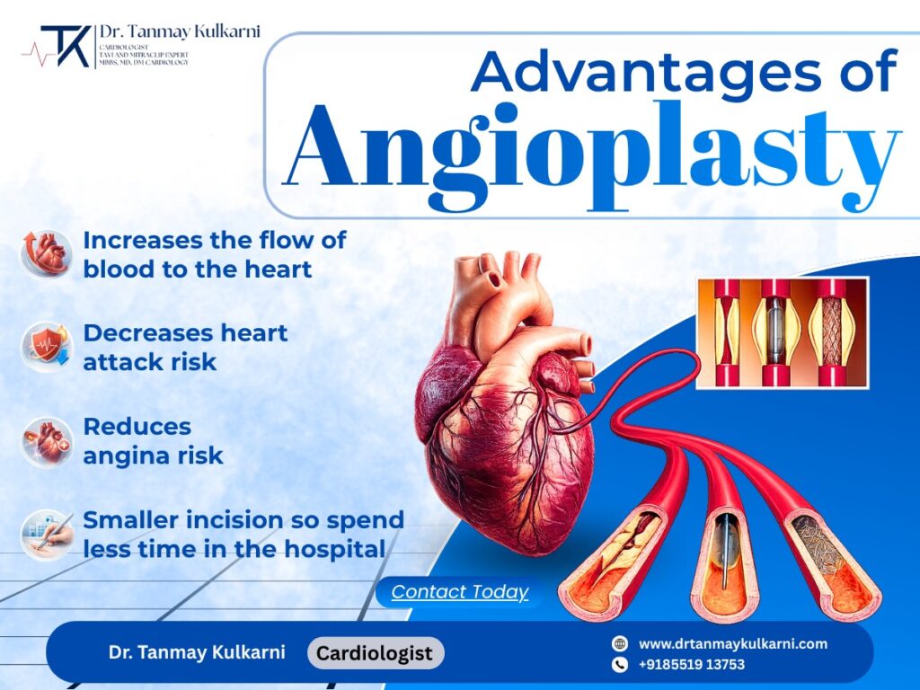 Advantages of Angioplasty: A Complete Guide by a Cardiologist in Pune