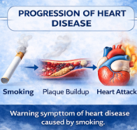 Progression of heart disease from smoking to plaque buildup and heart attack explained by Dr. Tanmay S Kulkarni Cardiologist in Pune