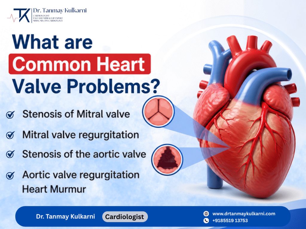 Common Heart Valve Problems: Symptoms, Causes & Treatment Options