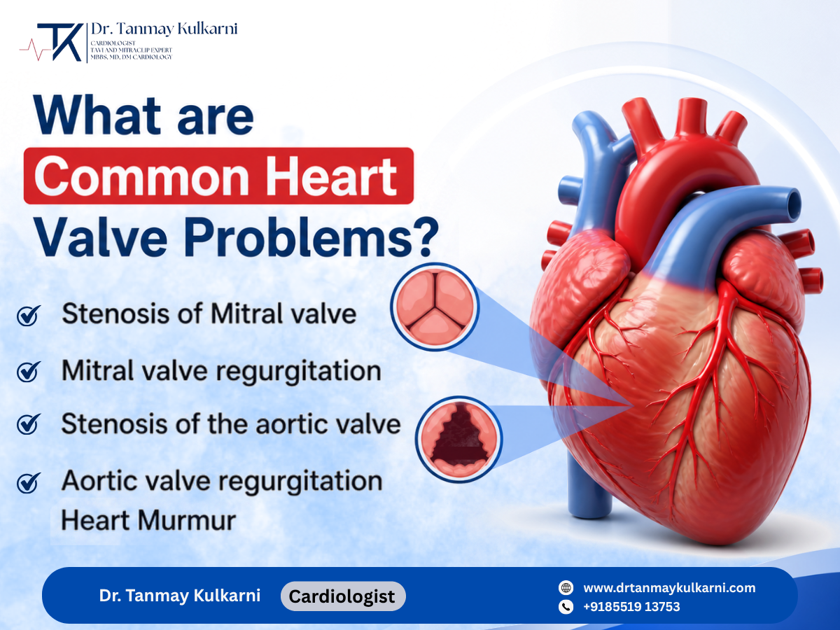 Educational graphic showing common heart valve problems with a detailed heart illustration.
