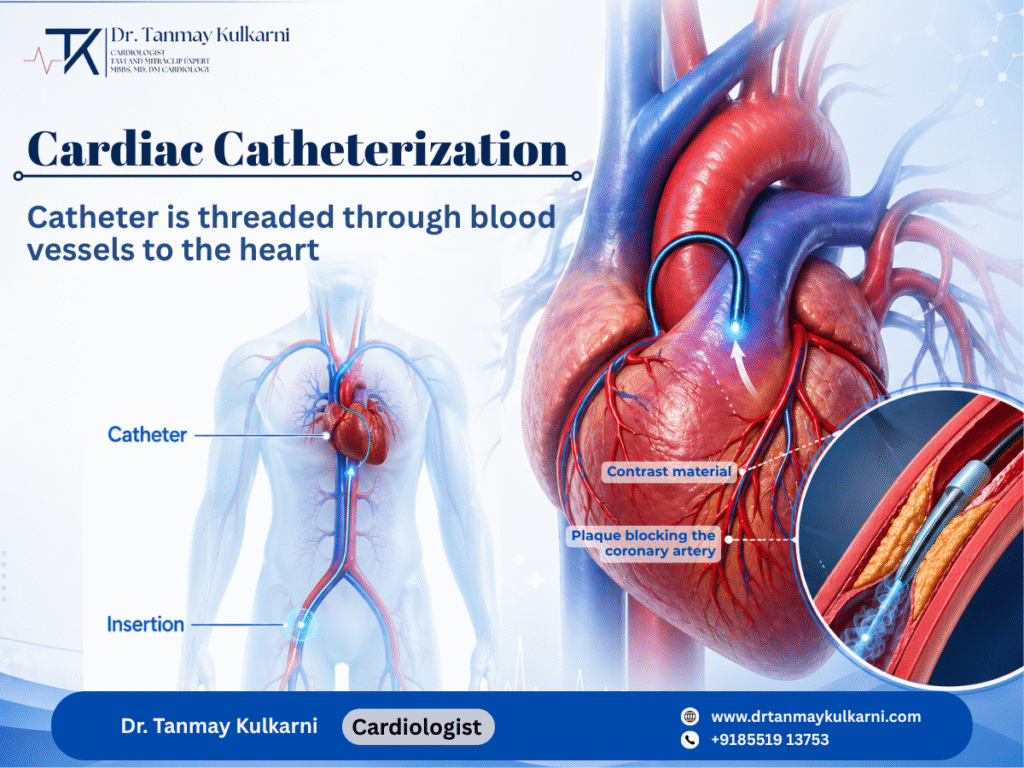 Cardiac Catheterization: A Life-Saving Heart Procedure Explained by a Cardiologist in Pune