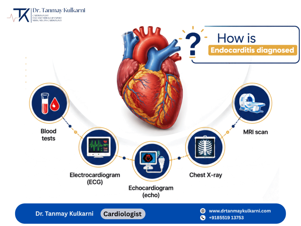 How is Endocarditis Diagnosed? Complete Guide by Dr. Tanmay S Kulkarni, Cardiologist in Pune
