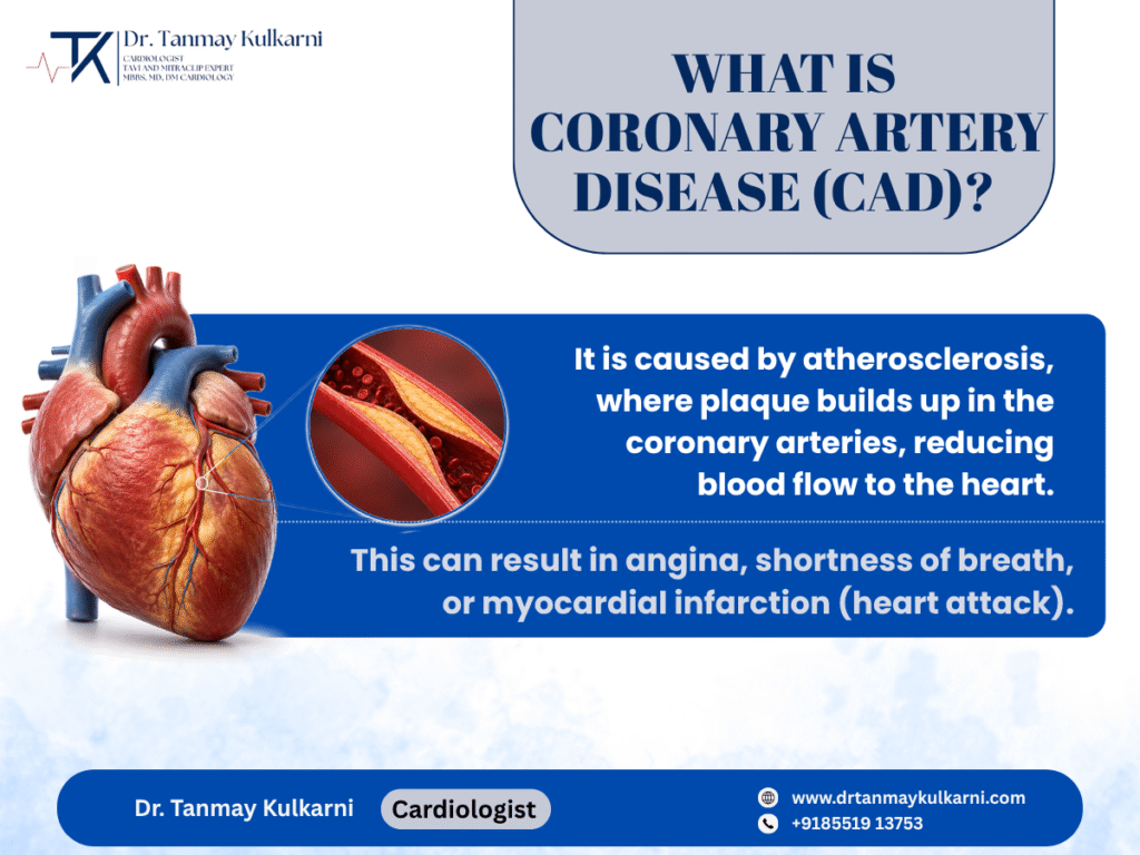 Coronary Artery Disease (CAD): Causes, Symptoms, Prevention & Treatment