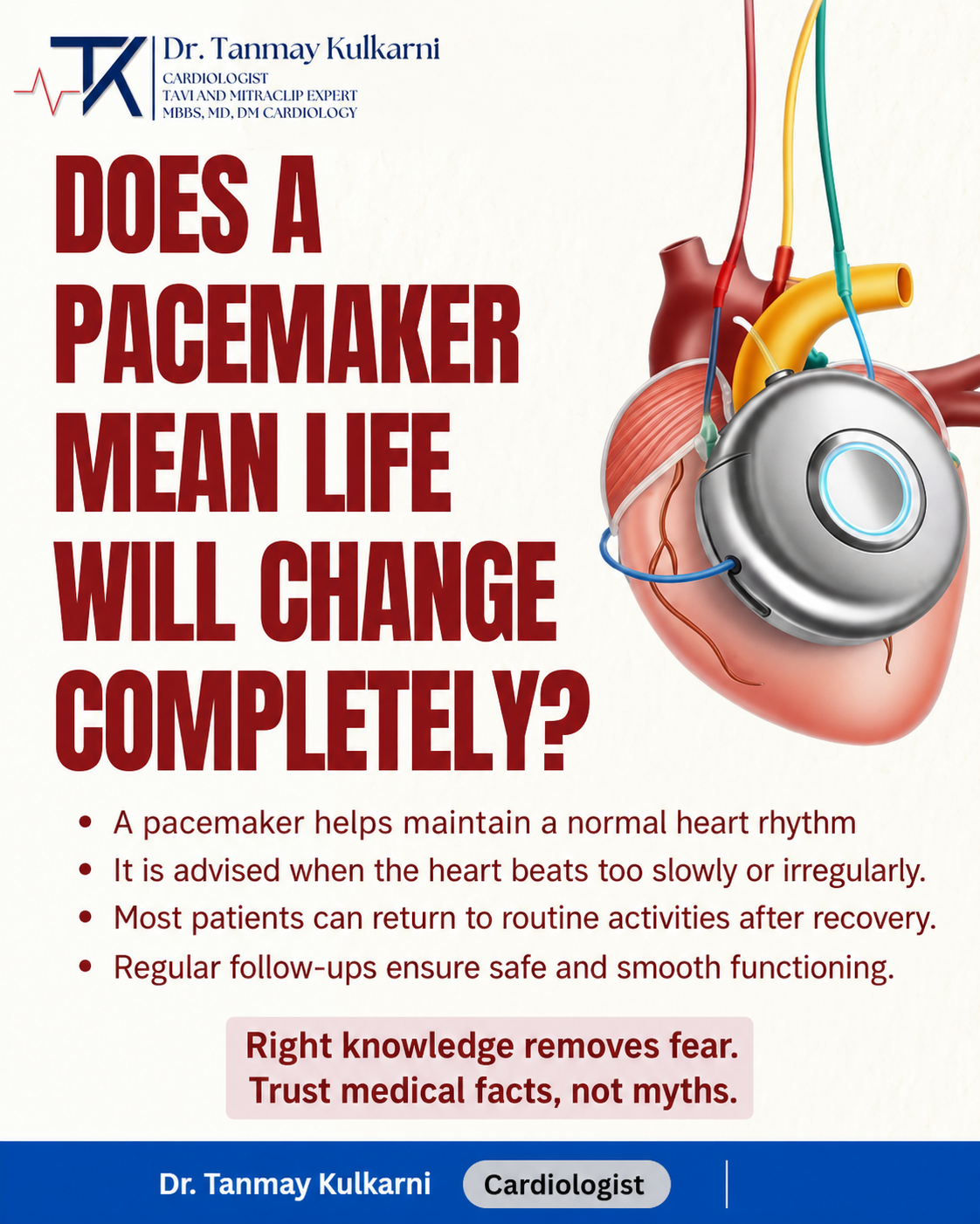 Pacemaker implanted in a heart illustration.