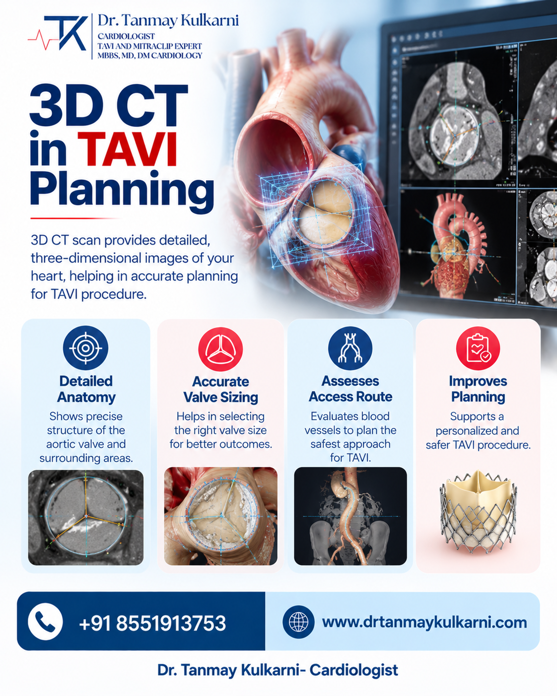 3D CT in TAVI Planning